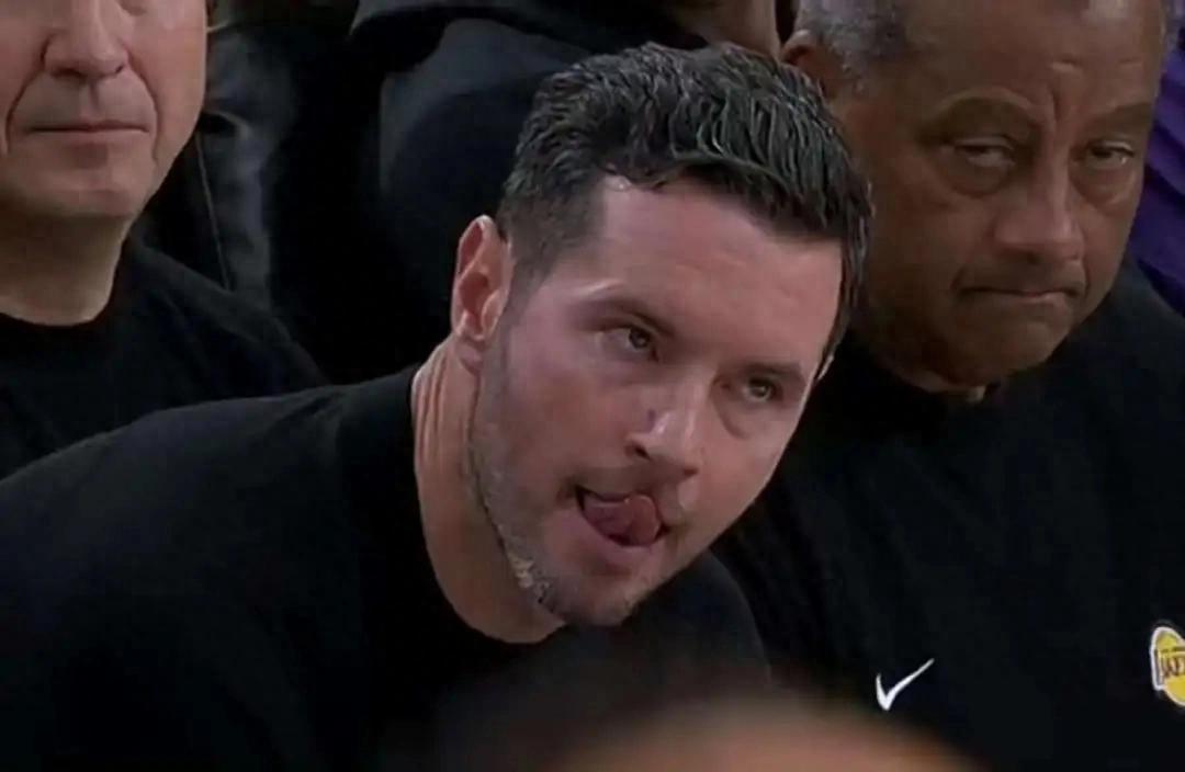 Doncic lại bị chấn thương! Lakers mang hơi ấm đến Clippers