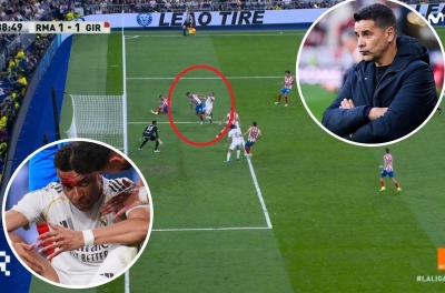 Mbappe đổ gục, phía Girona lên tiếng khiến Real nóng mặt