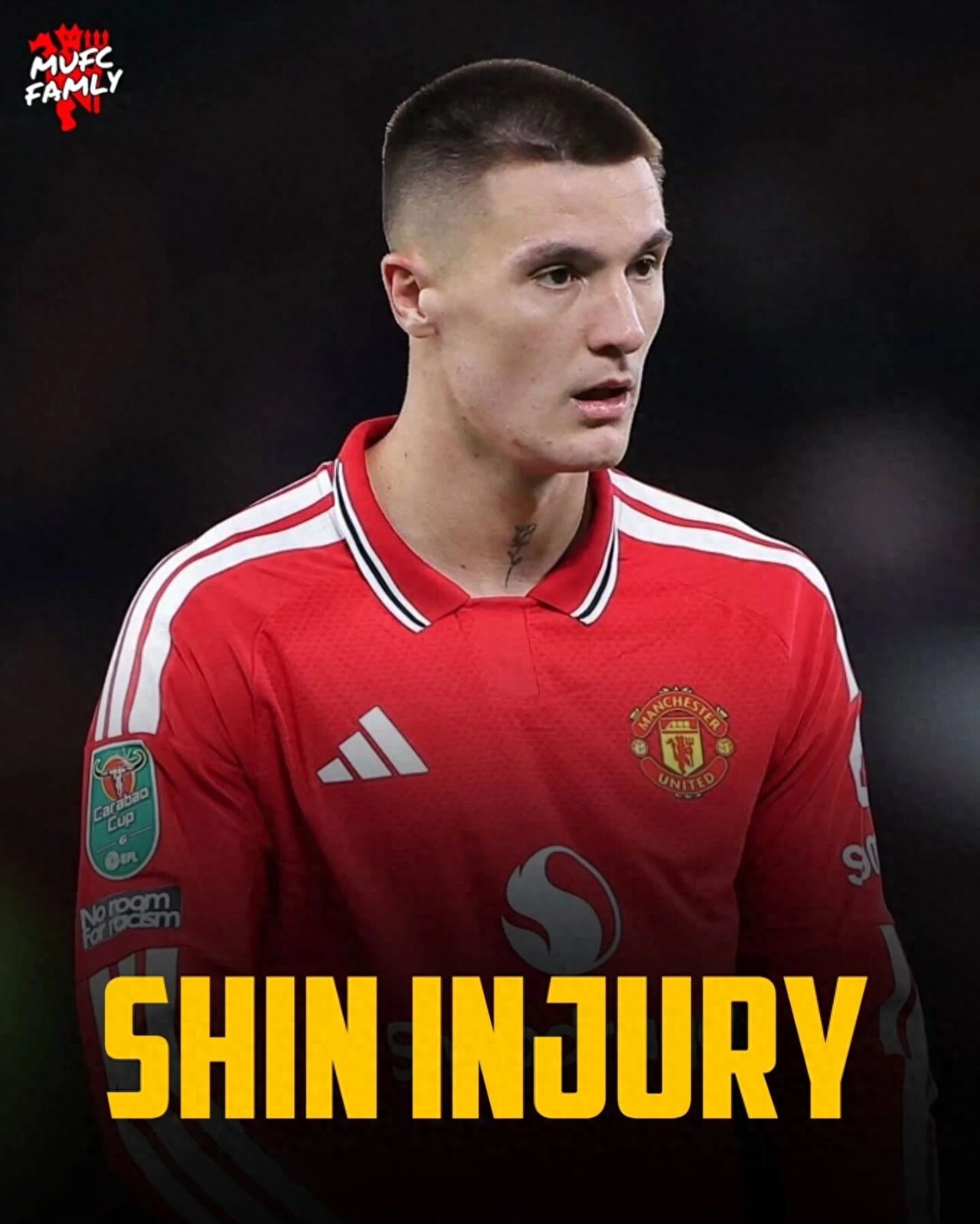 Sesko vắng mặt trong trận đấu tập của Manchester United, đội ngũ y tế vẫn đang nghiên cứu cách điều trị chấn thương kỳ lạ của anh! Rooney đã xin lỗi anh ấy