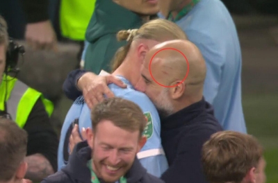 Pep Guardiola lại xuất hiện với vết xước trên đầu